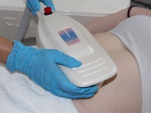 Fat-Freezing